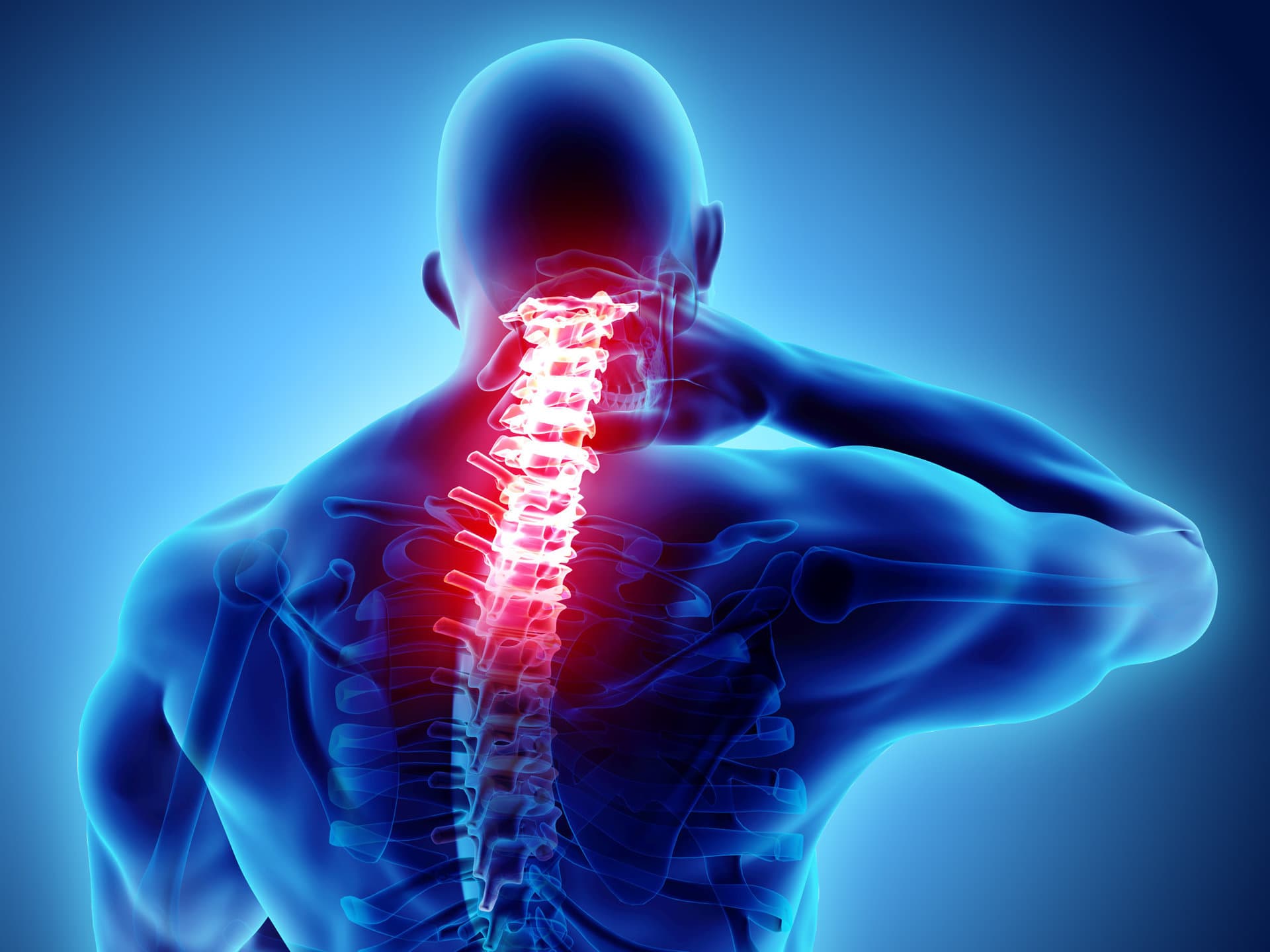 Spinal Fusion Procedure What You Need to Know