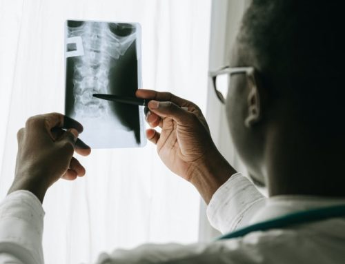 3 Tips for Finding Spinal Surgeons Near You